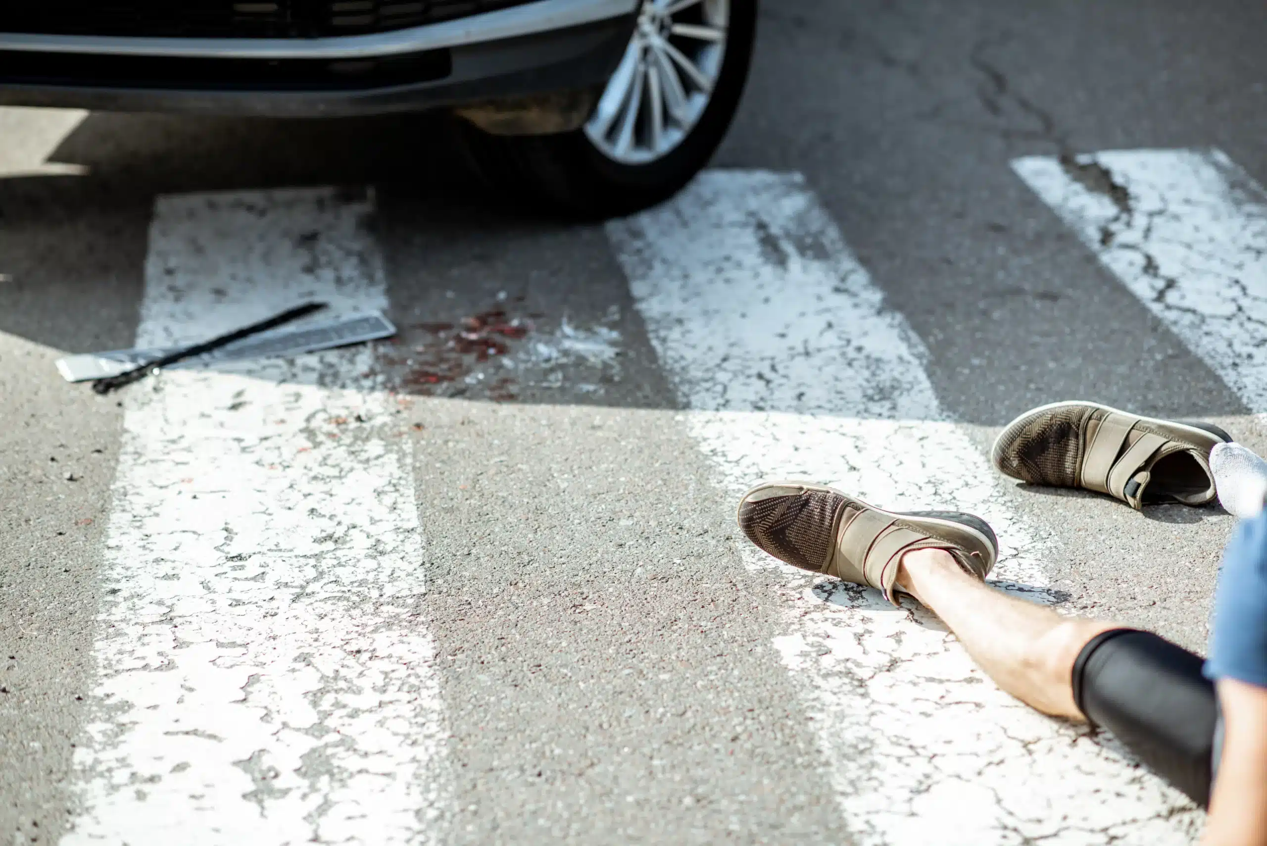 Person lying on zebra crossing near car wheel with blood and tool on ground, illustrating legal rights after a pedestrian accident in Illinois.